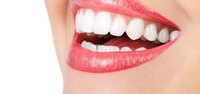Clear Braces